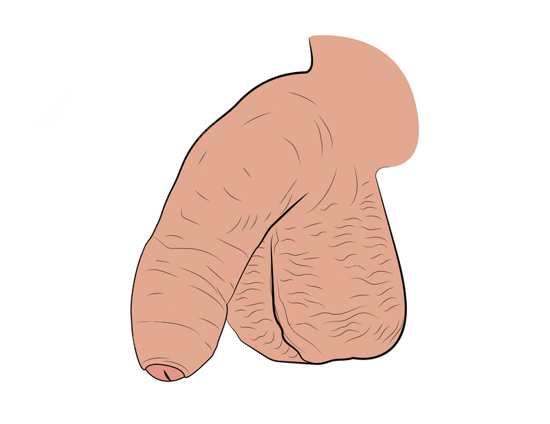 uncircumcised penis